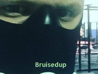 Bruisedup