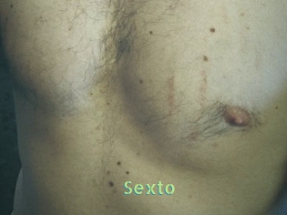 Sexto